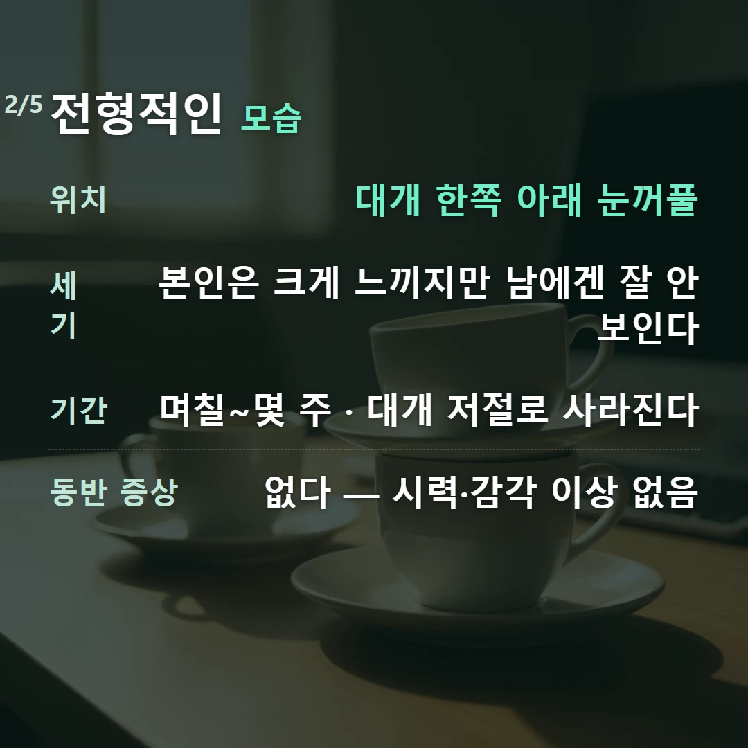 전형적인 모습 — 위치 대개 한쪽 아래 눈꺼풀, 세기 본인은 크게 느끼지만 남에겐 잘 안 보인다, 기간 며칠~몇 주 · 대개 저절로 사라진다, 동반 증상 없다 — 시력·감각 이상 없음