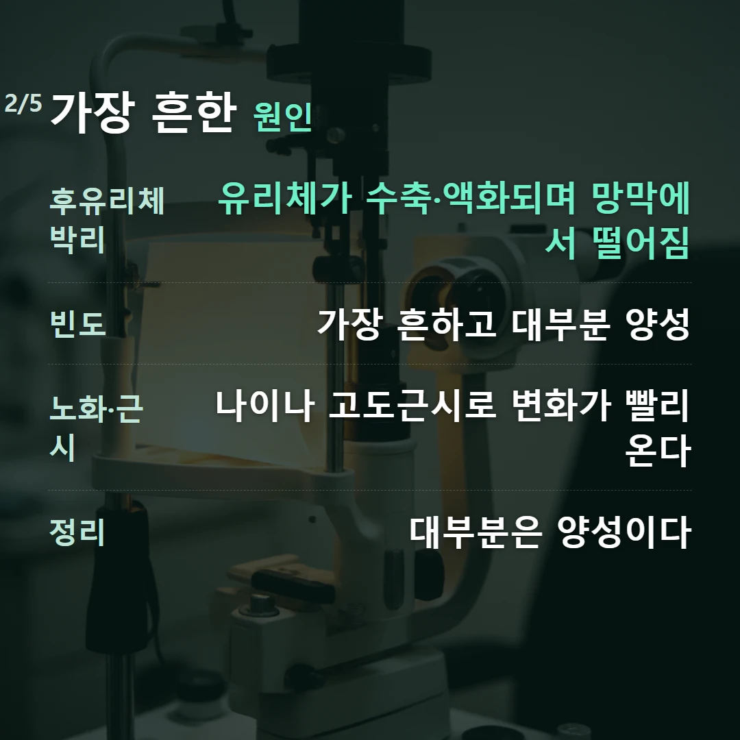 가장 흔한 원인 — 후유리체박리 유리체가 수축·액화되며 망막에서 떨어짐, 빈도 가장 흔하고 대부분 양성, 노화·근시 나이나 고도근시로 변화가 빨리 온다, 정리 대부분은 양성이다