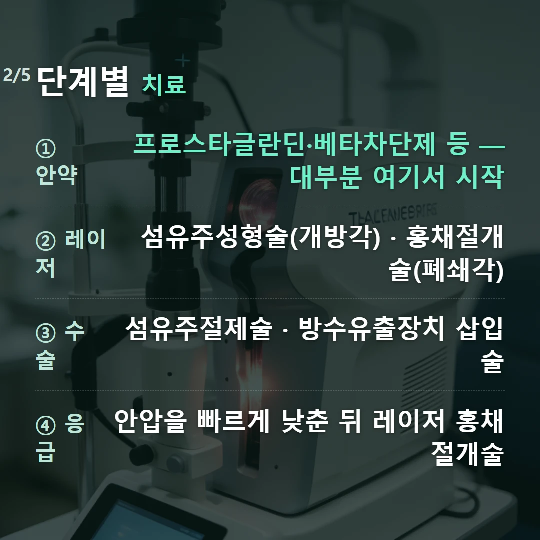 단계별 치료 — ① 안약 프로스타글란딘·베타차단제 등 — 대부분 여기서 시작, ② 레이저 섬유주성형술(개방각) · 홍채절개술(폐쇄각), ③ 수술 섬유주절제술 · 방수유출장치 삽입술, ④ 응급 안압을 빠르게 낮춘 뒤 레이저 홍채절개술